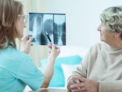 10 Tips Mengoptimalkan Lutut di Usia 50-an, Aktivitas Tetap Lancar