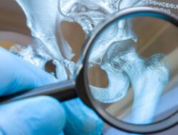 Awas Jangan Dilakukan! Ini 6 Kebiasaan yang Bisa Picu Asam Urat