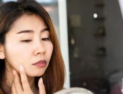 Bibir Hitam Tak Setiap Waktu karena Lipstik, Ini Dalang Aslinya